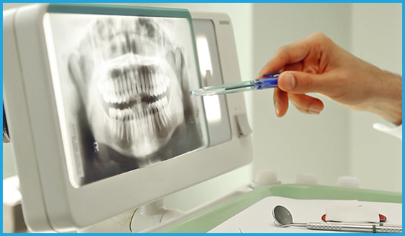 Denist is showing x-ray to patient